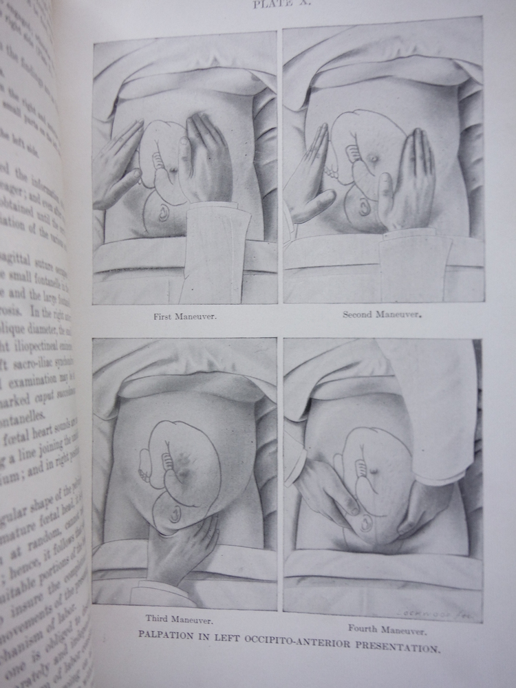 Image 2 of Obstetrics -- Fourth Enlarged and Revised Edition 1917