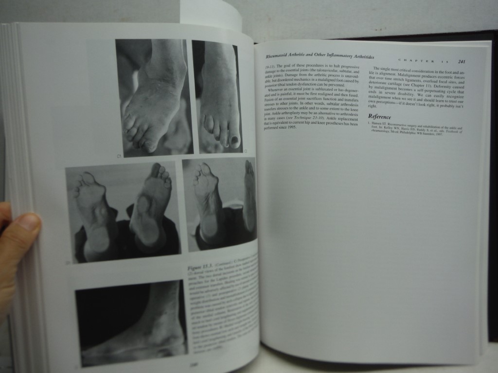 Functional Reconstruction of the Foot and Ankle