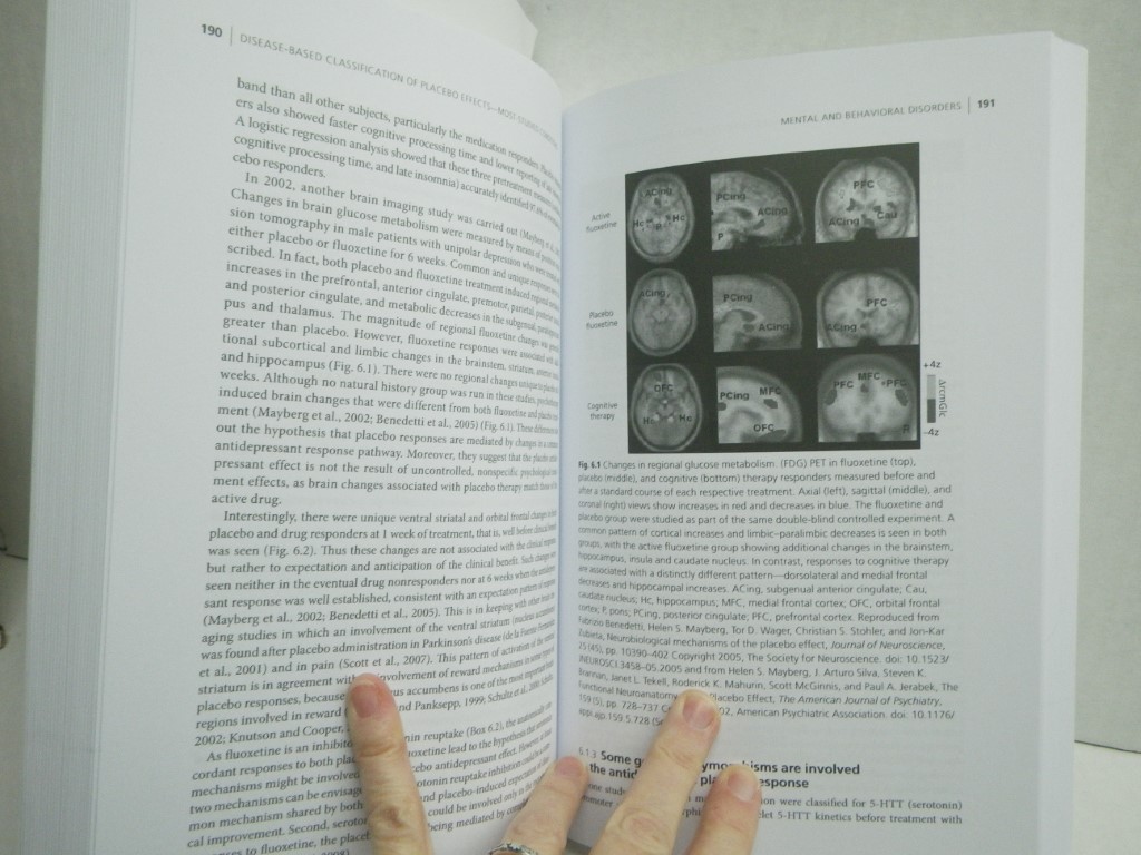 Image 3 of Placebo Effects: Understanding the mechanisms in health and disease