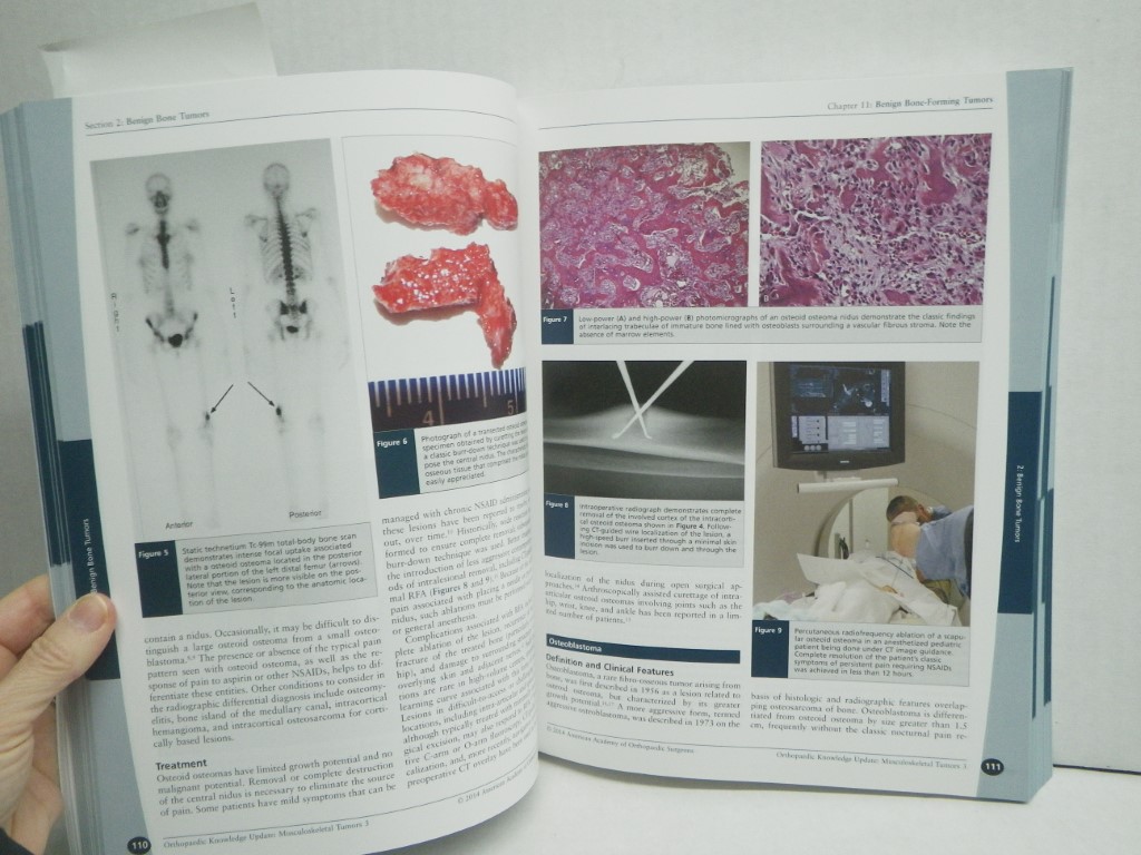 Image 2 of Orthopaedic Knowledge Update: Musculoskeletal Tumors 3