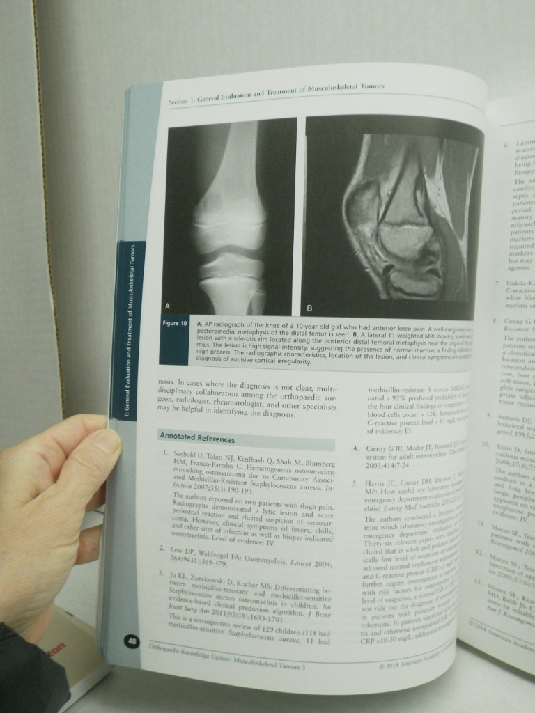 Image 3 of Orthopaedic Knowledge Update: Musculoskeletal Tumors 3