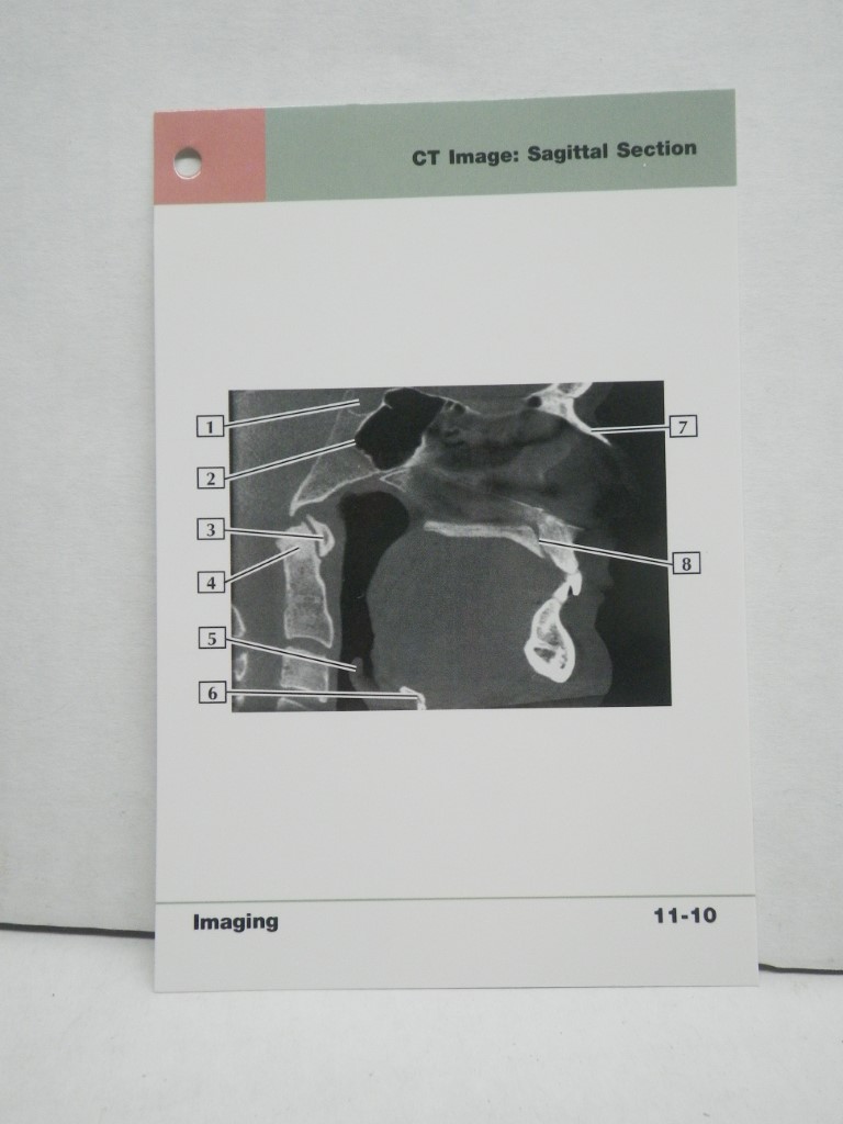Image 2 of Netter's Advanced Head & Neck Flash Cards (Netter Basic Science)