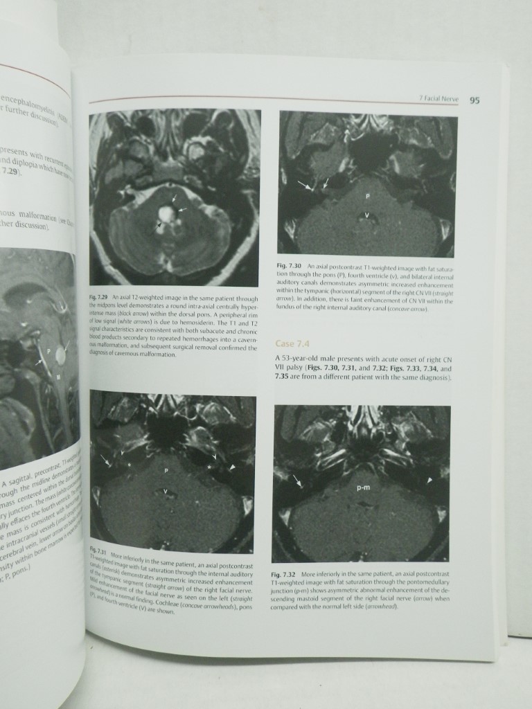 Image 3 of Cranial Nerves: Anatomy, Pathology, Imaging