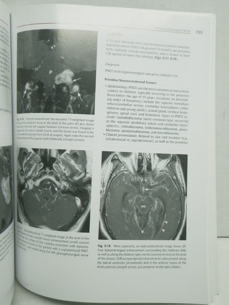 Image 4 of Cranial Nerves: Anatomy, Pathology, Imaging