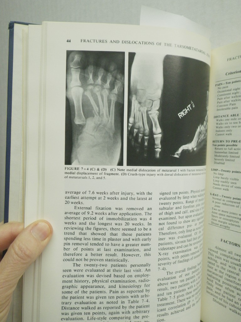 Image 4 of Foot and Ankle