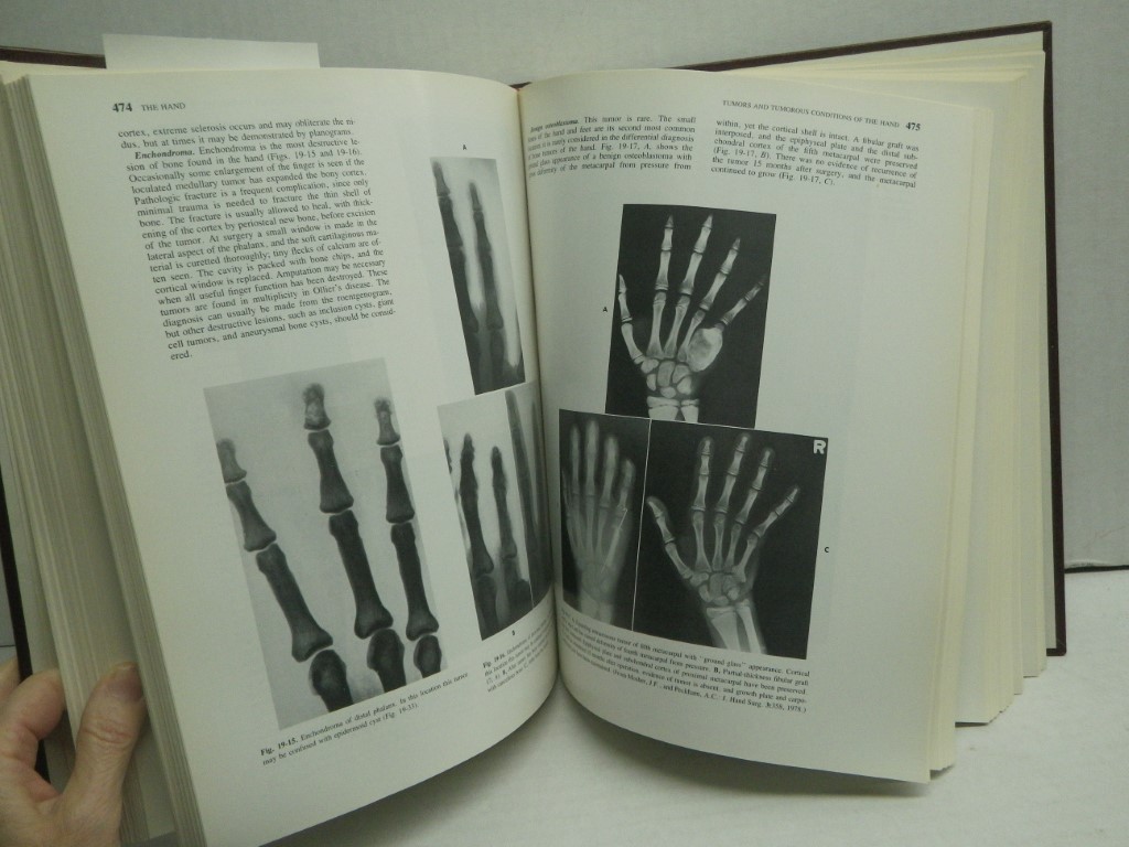 Image 2 of Campbell's Operative Orthopaedics Volume 1