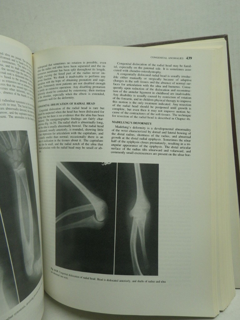 Image 3 of Campbell's Operative Orthopaedics Volume 1