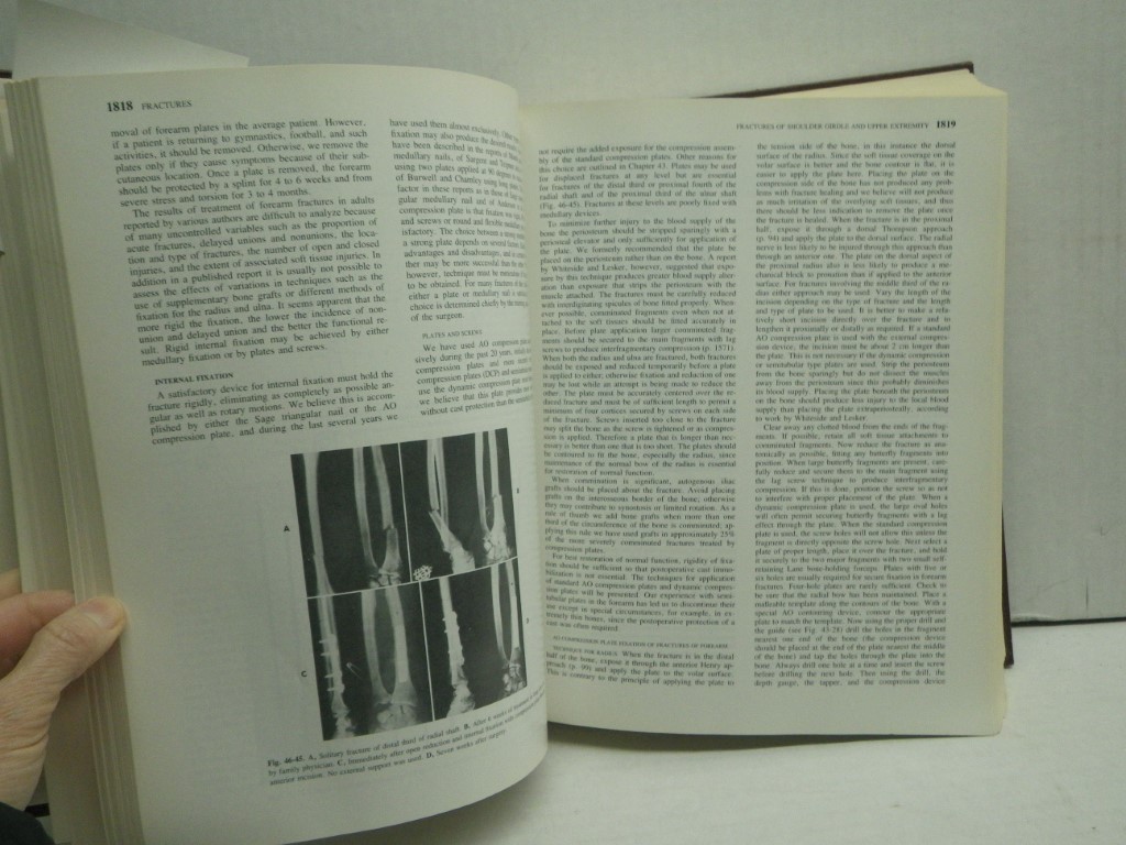 Image 4 of Campbell's Operative Orthopaedics  Volume 3